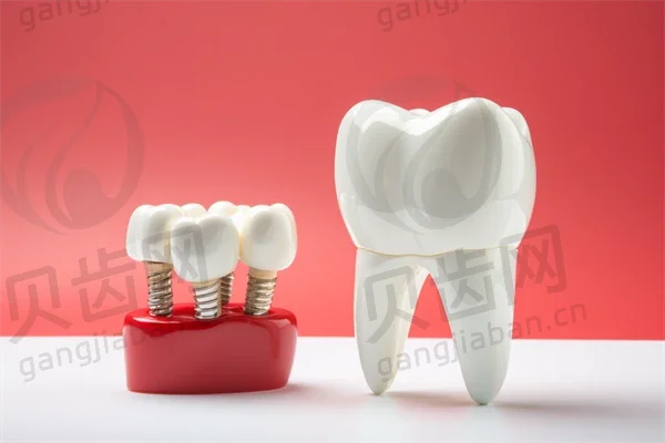 东莞雅道口腔门诊部龋齿填充收费现仅需500元起，原价800元起，限时优惠，欢迎前来体验优质服务！