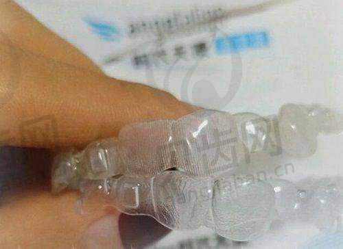 看牙技术优势
