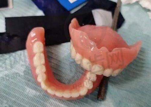 总结