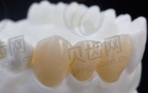 总结