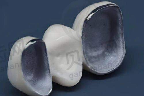 总结