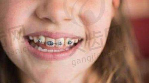 收费价格：性价比高的口腔诊疗选择