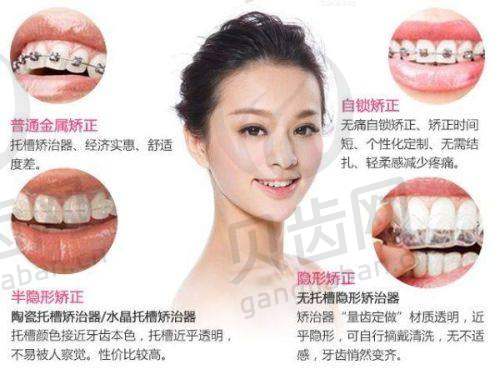 黄石瑞橙口腔靠不靠谱?