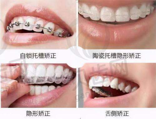 价格参考与项目详情