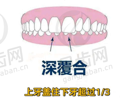 患者实例分享