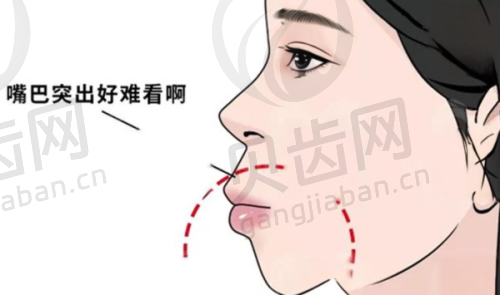 总结