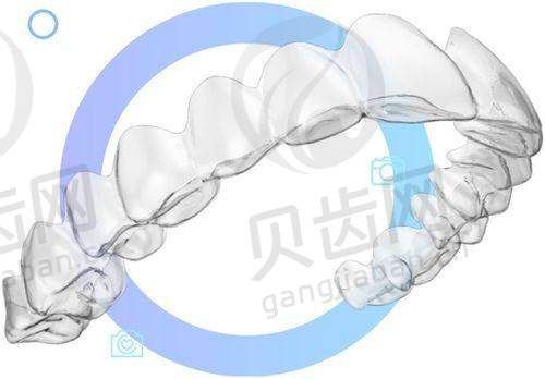 单颗种植牙价格