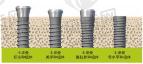 牙齿矫正情况