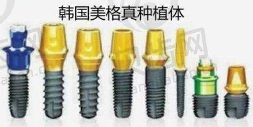固定修复（牙冠）价格