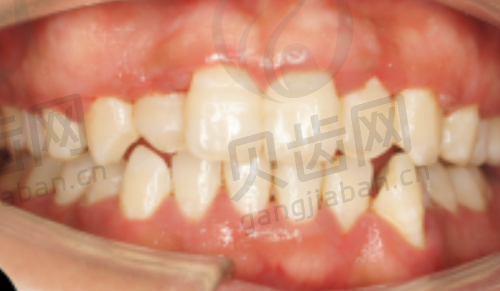 精良的设备支持