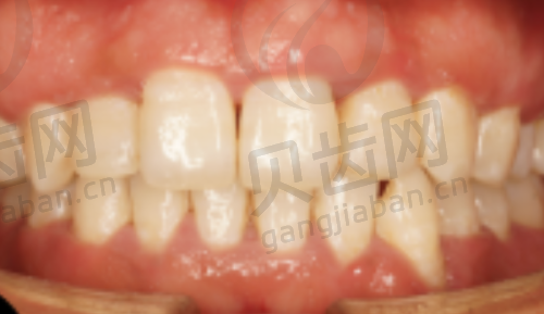 总结