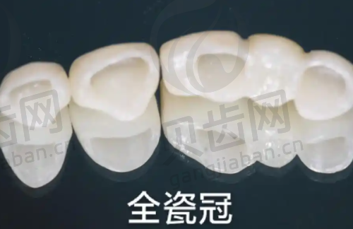 其他热门项目