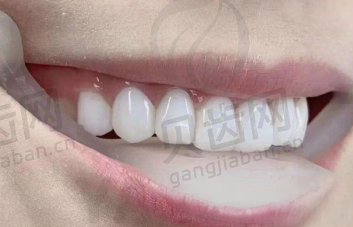 总结