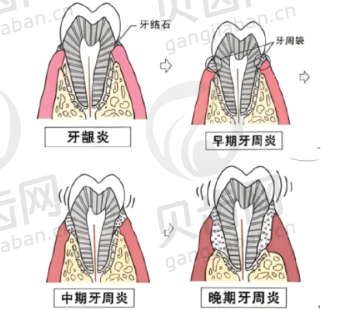 山东菏泽单县新天元口腔的项目价格