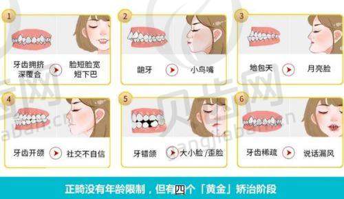 儿童牙齿矫正项目
