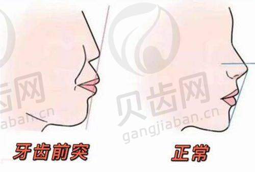 南坪分院情况