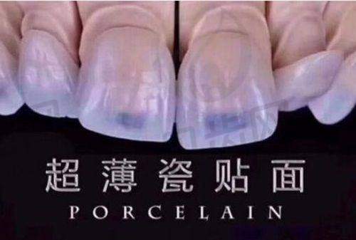 核心优势