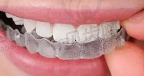 秦皇岛口腔医院的就诊体验