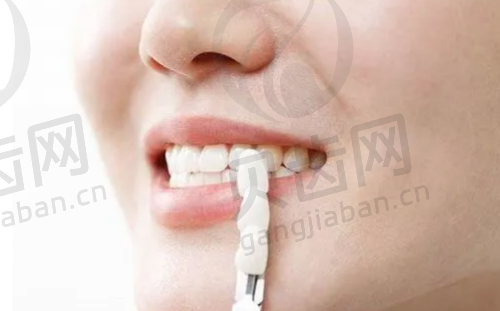 患者关注问题