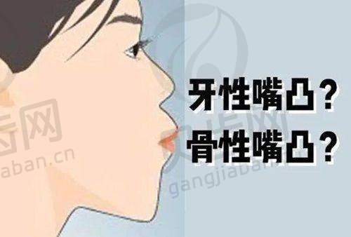 预约方式